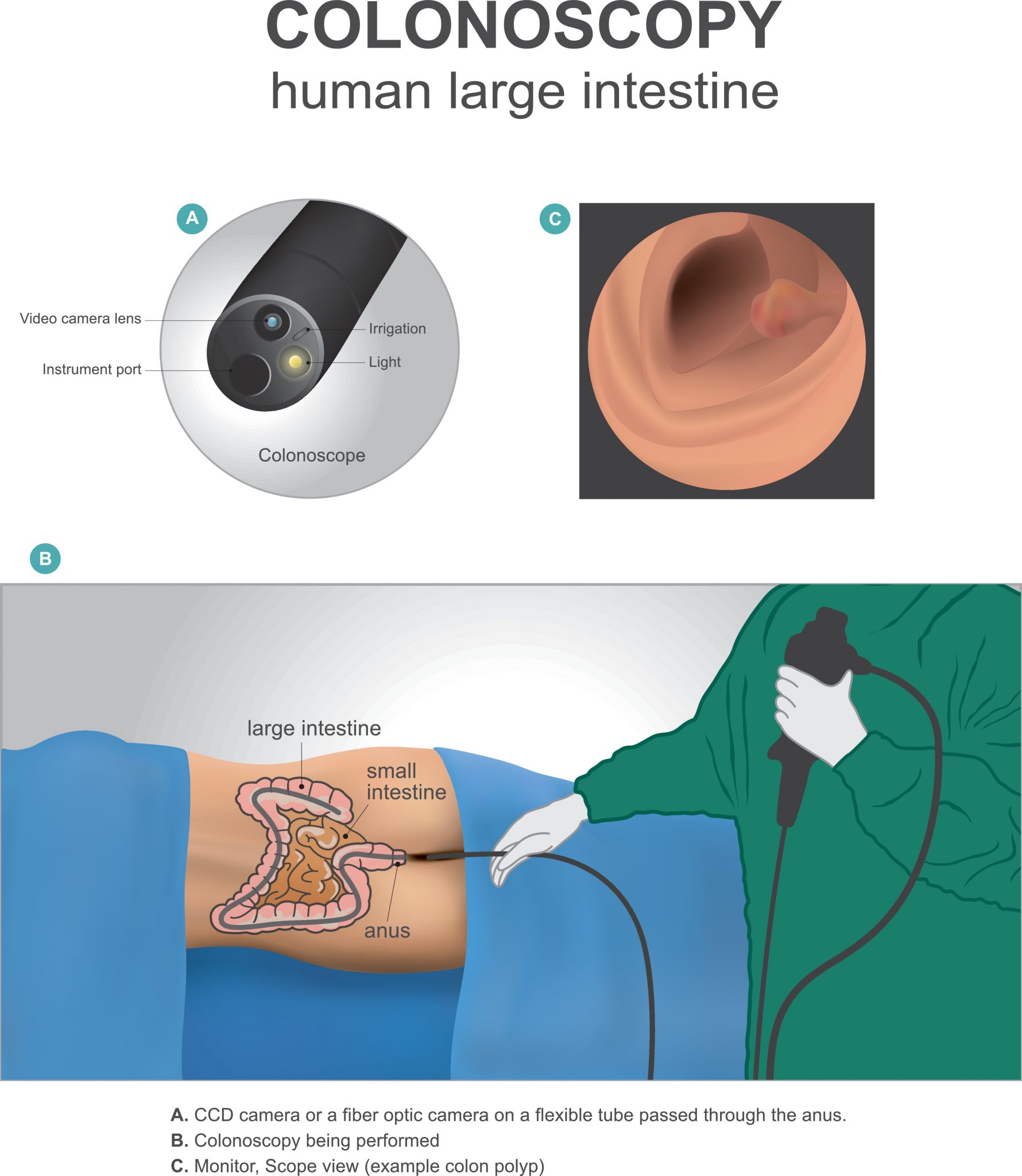 Understanding Colonoscopy A Comprehensive Guide To Screening And