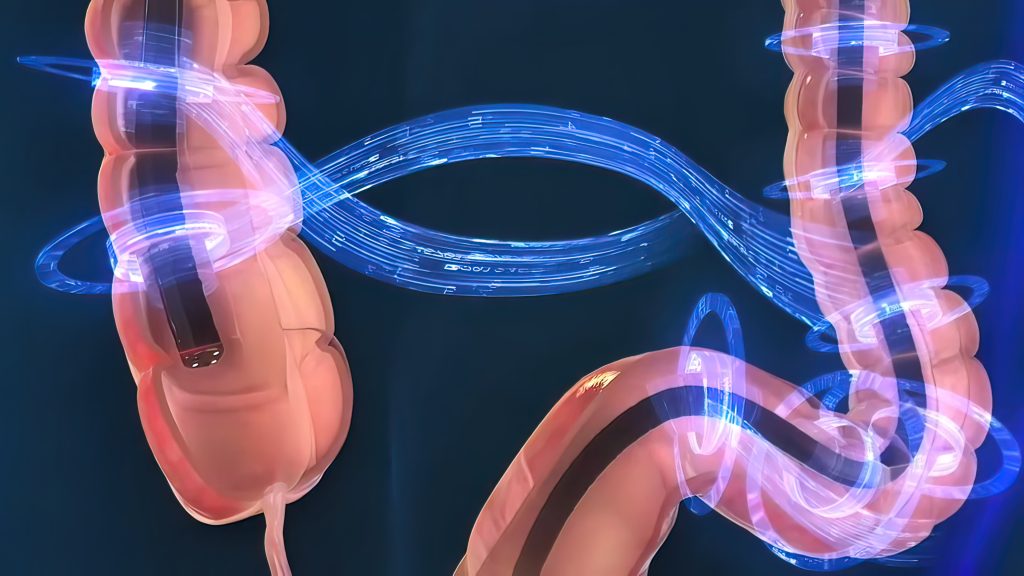 3d human digestive colonoscopy proceduire